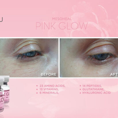 Pink Glow 1 box (10 x 5ml vial) 5